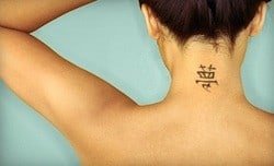 reasons for laser tattoo removal