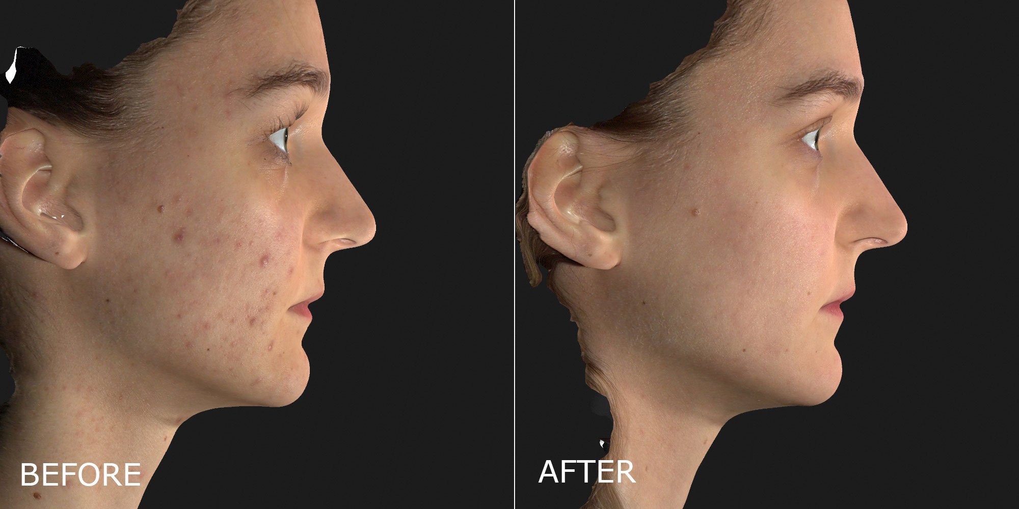 Before & After Gallery - DermMedica