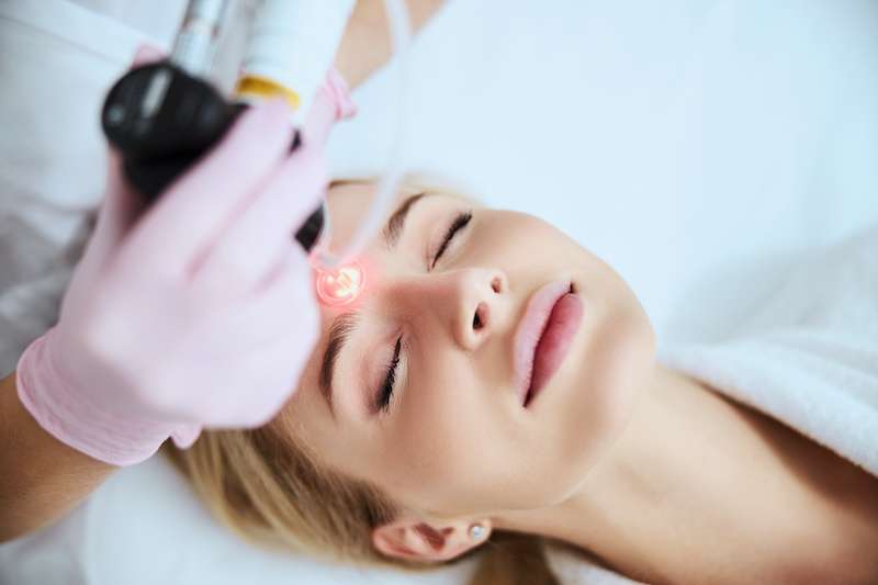 woman receiving dermapeel laser treatment
